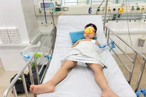 Vào cấp cứu do viêm cơ tim cấp, bé 5 tuổi được phát hiện nhiễm Covid-19 trước đó