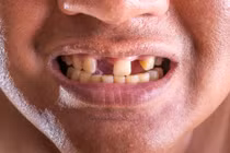 Các nhà khoa học tìm ra cách có thể giúp con người mọc lại răng