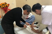 Chỉ định thay toàn bộ xương đùi