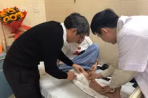 Chỉ định thay toàn bộ xương đùi