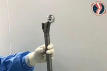 Thay xương đùi cho bệnh nhi ung thư nhỏ tuổi nhất Việt Nam