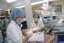 Niềng răng, những điều chưa biết