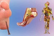 Các bệnh có thể dự phòng bằng vắc-xin: Bệnh uốn ván