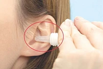 Có nên nhỏ nước muối sinh lý vào tai?