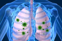 Bệnh viêm phổi có nguy hiểm không? Điều trị bao lâu thì khỏi?