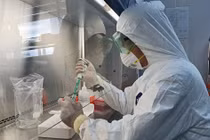 TP.HCM: Làm rõ vụ lấy mẫu xét nghiệm RT-PCR Covid-19 tại nhà giá 1,2 triệu đồng