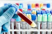 Sử dụng trí tuệ nhân tạo dự đoán khả năng sống của bệnh nhân Covid-19