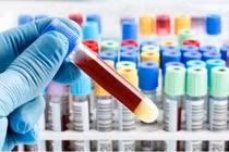 Sử dụng trí tuệ nhân tạo dự đoán khả năng sống của bệnh nhân Covid-19