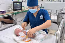 Bé gái sinh non mắc nhiều bệnh lý phức tạp