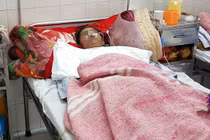 Chàng trai vạm vỡ còn da bọc xương vì ăn tiết canh