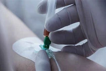 Lần đầu tiên trực tiếp sửa gene trong cơ thể bệnh nhân