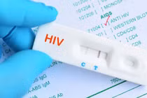 Bất ngờ phát hiện mắc HIV