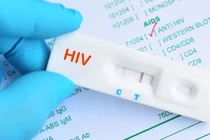 Bất ngờ phát hiện mắc HIV