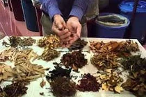 Hỗ trợ điều trị chứng đau nhức gân, xương