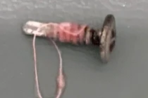 Trẻ mầm non tử vong thương tâm do hóc đinh vít