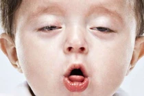 Con viêm mũi họng tái đi tái lại vì bố hút thuốc