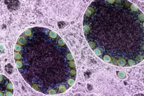 Khả năng lây lan của biến thể COVID-19 mới XE cao hơn tới 43% so với Omicron