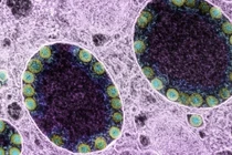 Khả năng lây lan của biến thể COVID-19 mới XE cao hơn tới 43% so với Omicron