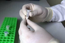 “Chạy đua” công nghệ giám định ADN hài cốt liệt sĩ