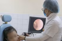 Bé gái 5 tuổi bị hạt cườm rơi vào tai