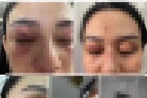 Người bị đánh ở shop Trang Nemo lên tiếng: Giang hồ cả chục đánh 1 người phụ nữ mới sinh