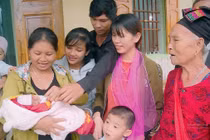 Laser quang đông cứu sống thai nhi mắc hội chứng truyền máu song thai