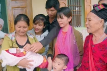 Laser quang đông cứu sống thai nhi mắc hội chứng truyền máu song thai