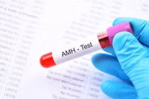 Xét nghiệm AMH chẩn đoán khả năng sinh sản