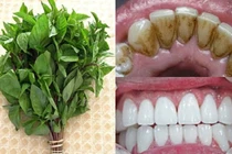 Thực hư tẩy trắng răng bằng vỏ cam và húng quế