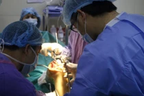 Nguyên nhân thất bại trong phẫu thuật thay khớp gối