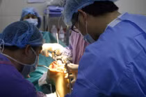 Nguyên nhân thất bại trong phẫu thuật thay khớp gối