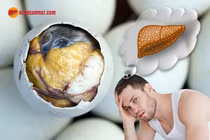  Bụng trướng to vì thách nhau ăn trứng vịt lộn