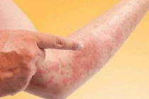 Thực phẩm dưỡng gan 