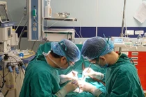 Trẻ đau bụng, vàng da cẩn thận u nang ống mật chủ