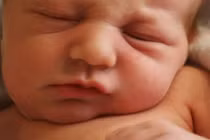 Phục hồi chức năng cho trẻ bị vẹo cổ bẩm sinh