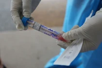 Đồng Nai phát hiện ca nghi Covid-19