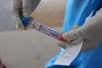 Đồng Nai phát hiện ca nghi Covid-19