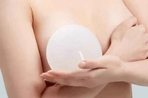 Túi ngực có thế bị rách, thủng... chứ không thể bị nổ