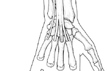  Kích thích huyệt tay điều trị cổ cứng đau