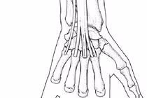  Kích thích huyệt tay điều trị cổ cứng đau