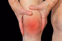 Nên xét nghiệm axit uric định kỳ để tránh gút cấp