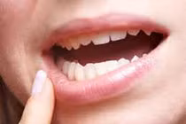 Nổi cục thịt dưới nướu