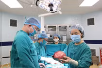 Cắt khối u xơ tử cung nặng 3kg