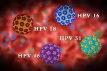Nhiễm HPV và ung thư