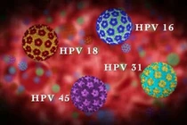 Nhiễm HPV và ung thư