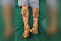 Đến Tết lại lo bệnh liên cầu lợn