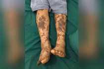 Đến Tết lại lo bệnh liên cầu lợn