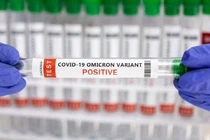 Cảnh báo mới về các biến thể Omicron ảnh hưởng phổi