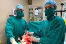 Bảo tồn tử cung khi bóc u xơ tử cung “khủng” 