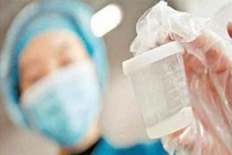 Nam giới có thể dị ứng với tinh dịch của chính mình